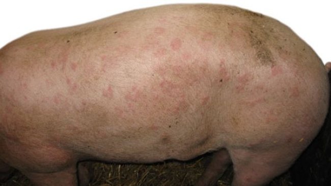 Forme cutanée ou urticante du rouget