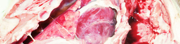 Pleur&eacute;sie fibrineuse chronique