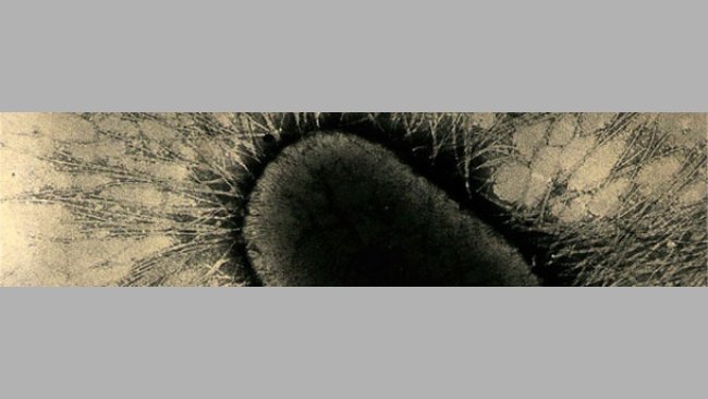 les facteurs d'adhésion d'ETEC sont les protéines spécialisées des fimbriae ou pili qui adhèrent fortement aux récepteurs glycoprotéiques des cellules intestinales.