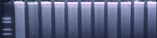 PCR fluorog&eacute;nique pour d&eacute;tecter le SDRPv.