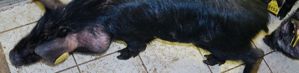 M&eacute;lanome et m&eacute;tastase dans les ganglions