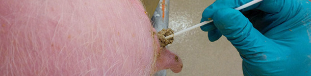 Ecouvillonnages rectaux