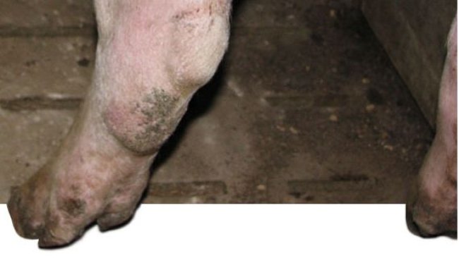 Membre postérieure d'une nullipare