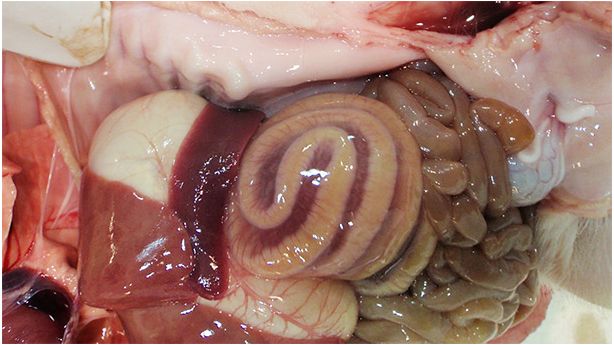 L'&oelig;d&egrave;me de m&eacute;socolon est une l&eacute;sion typique des cas d&rsquo;ICD