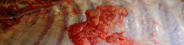 Pleur&eacute;sie sur les poumons