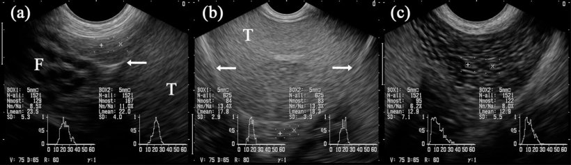 Figure 5: images échographiques des segments épididymaires: caput (= tête, a), corpus (b) et cauda (= queue; c). Les cases marquées « + » et « x » sont projetées sur les segments respectifs de l'épididyme. Testicule (T). Adjacente à la tête il y a plusieurs structures tubulaires identifiées comme étant des parties du funiculus spermaticus (F). Les flèches indiquent la couverture séreuse du testicule (c'est à dire la bursa) testicularis. (Kauffold et al., 2011)
