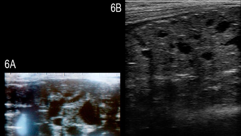 Figure 6: Images de la glande bulbo-urétrale d'un verrat atteint par de multiples kystes anéchogéniques bien définis de différentes tailles (A) et d'un verrat sain (B) (Grahofer et al., 2016).