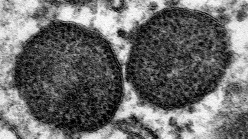 Microphotographie &eacute;l&eacute;ctronique de deux corps d'inclusion dans le cytoplasme d'un macrophage qui incluent&nbsp;un nombre tr&egrave;s &eacute;lev&eacute; de particules de PCV2. 150.000x. Source: Carolina Rodr&iacute;guez-Cari&ntilde;o, CReSA
