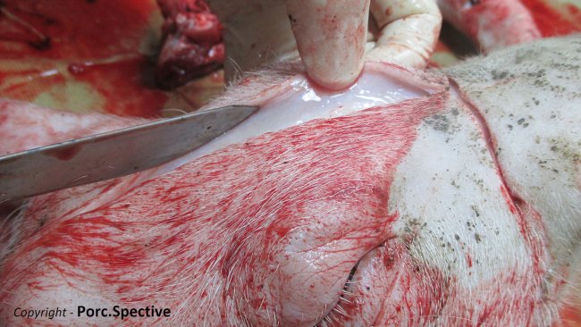 Photo 1. oedème sous-cutané de la face