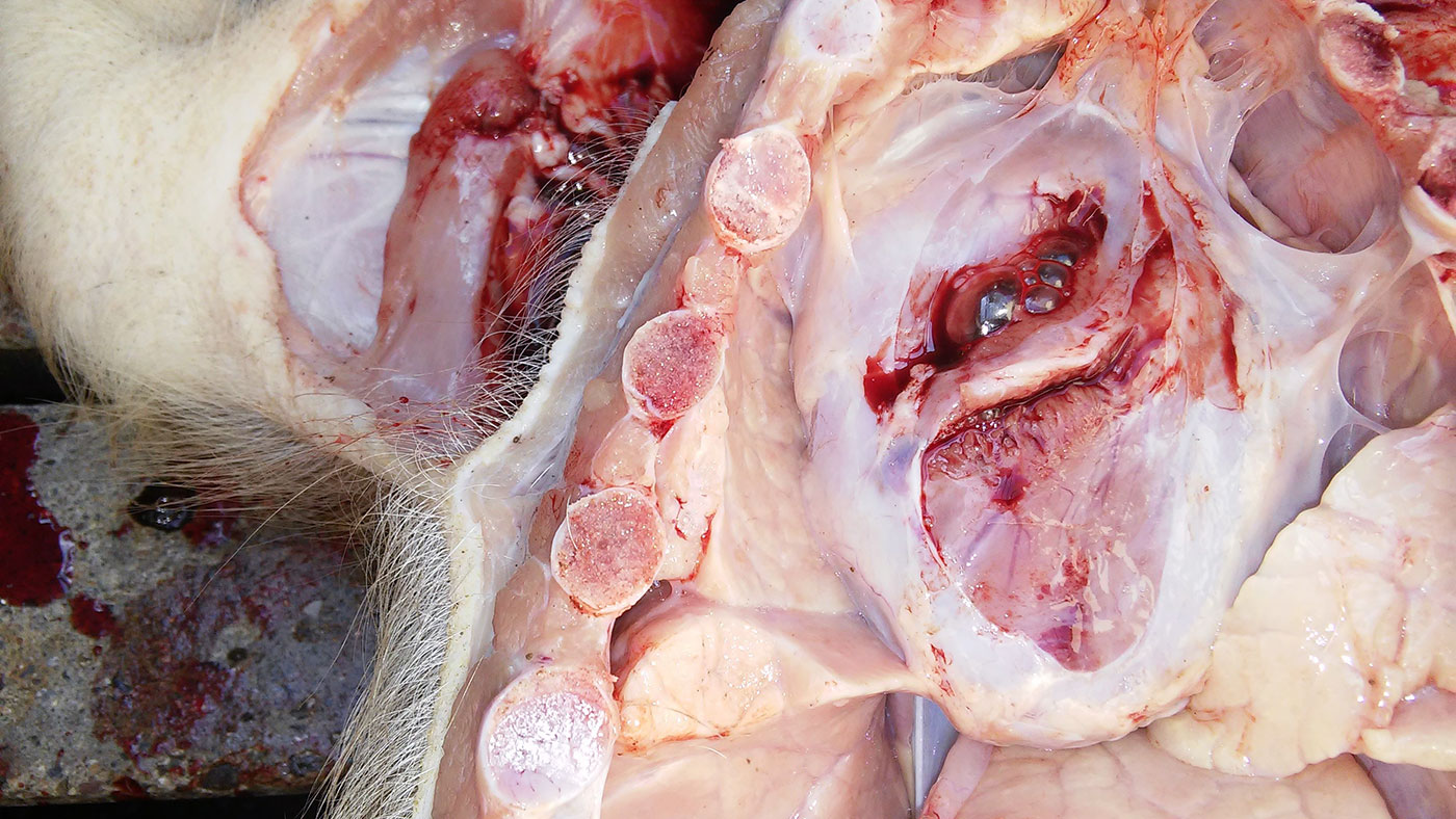 <p>Figure 5. Péricardite.</p>