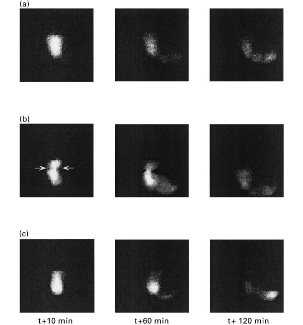 <p>Figure 1. Images de la vidange gastrique chez les porcs nourris avec un régime à base d'amidon (a), de pulpe de betterave (b) et de son de blé 10, 60 et 120 minutes après l'ingestion (Source: Guerin et al., 2001) ).</p>