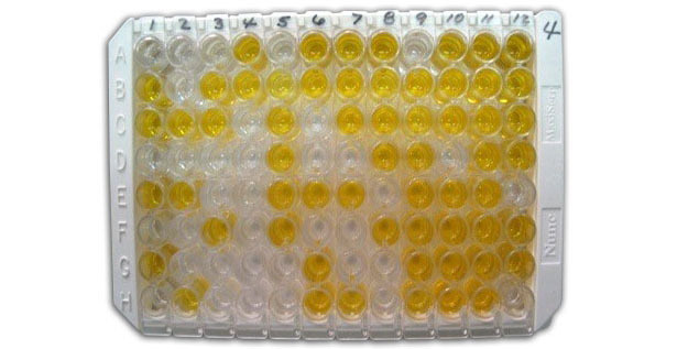 <p>Figure 1: ELISA indirect pour la d&eacute;tection d'anticorps anti-Chlamydia dans le s&eacute;rum.</p>
