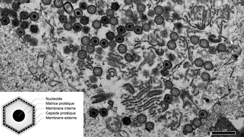 Image en microscopie &eacute;lectronique d&#39;une cellule infect&eacute;e par le virus de la PPA.
