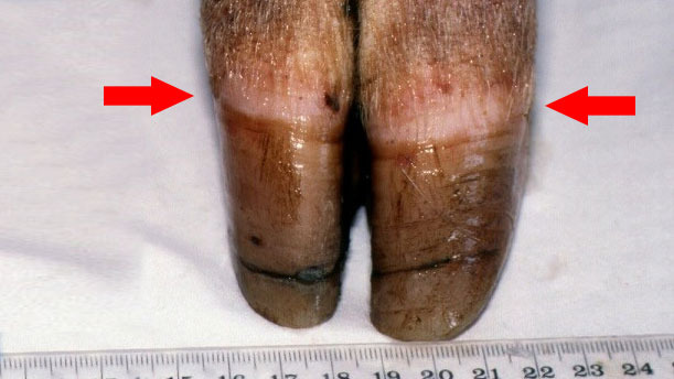 Figure 1. Bande coronaire [fl&egrave;che]. Notez la croissance in&eacute;gale et la fissuration du sabot.

