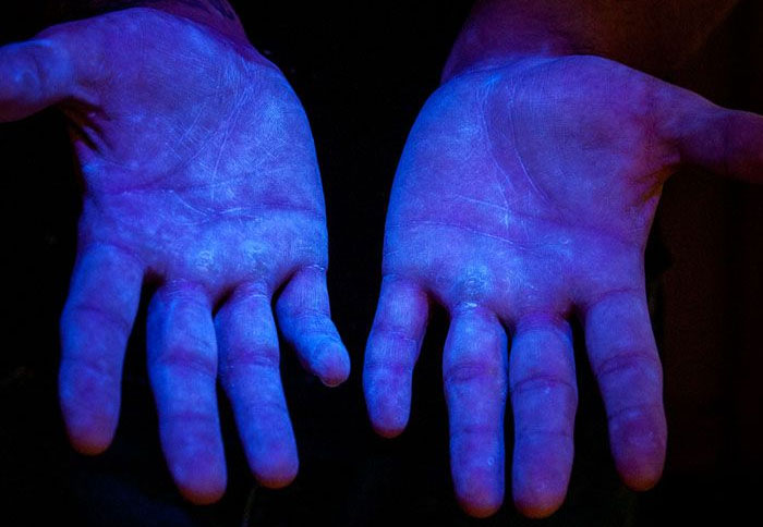 Photo 6. Matière fluorescente sous ultraviolets (UV) pour démontrer que le produit couvre toutes les mains. Source www.glogerm.com