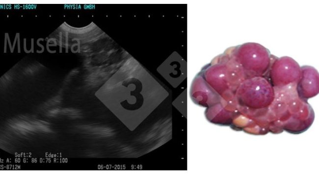 Figure 1. Corps jaune.