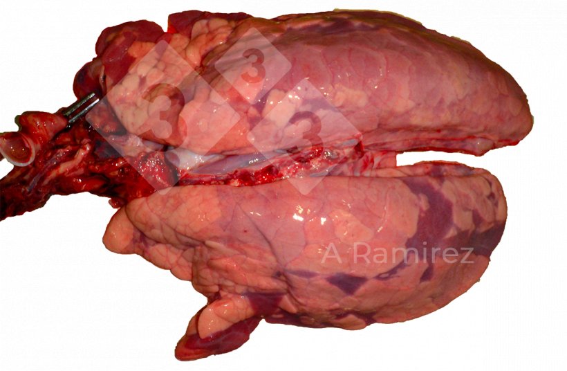 Figure 3 : Infection diffuse par influenza A avec un l&eacute;ger &oelig;d&egrave;me interlobulaire..
