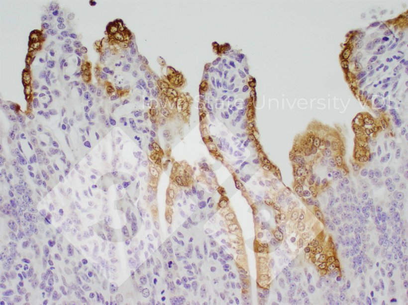 Figure 1 : Coloration IHC de la DEP dans l&#39;intestin gr&ecirc;le infect&eacute;. Source : Iowa State University VDL.
