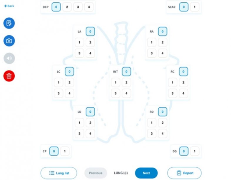 Figure 2 : Logiciel num&eacute;rique utilis&eacute; pour l&#39;&eacute;valuation. Les parties des poumons &eacute;valu&eacute;es sur une &eacute;chelle de points comprenaient le lobe apical gauche, le lobe cardiaque gauche, le lobe diaphragmatique gauche, le lobe moyen, le lobe diaphragmatique droit, le lobe cardiaque droit, le lobe apical droit, ainsi que les zones affect&eacute;es par la pleur&eacute;sie cr&acirc;niale, la pleur&eacute;sie dorso-caudale et la pr&eacute;sence de cicatrices.
