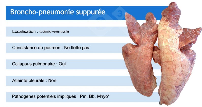 Pm : Pasteurella multocida ; Bb : Bordetella bronchiseptica ; Mhyo : Mycoplasma hyopneumoniae.
*Mhyo est souvent impliqu&eacute; dans les bronchopneumonies suppur&eacute;es en tant que pathog&egrave;ne initiateur (provoquant d&#39;abord une pneumonie broncho-interstitielle).
