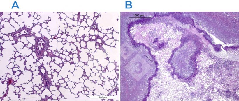 Figure 2 : Coloration &agrave; l'h&eacute;matoxyline-&eacute;osine d'un poumon normal (A) et d'un poumon atteint (B). Le poumon en B est atteint d'une pleuropneumonie fibrino-n&eacute;crotique caus&eacute;e par Actinobacillus pleuropneumoniae.
