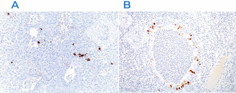 Figure 3 : Immunohistochimie pour d&eacute;tecter le virus du syndrome dysg&eacute;n&eacute;sique et respiratoire porcin (SDRP) (A) et le virus de la grippe porcine (B). La pr&eacute;sence de l&#39;antig&egrave;ne viral (coloration brune) est observ&eacute;e dans les zones atteintes.
