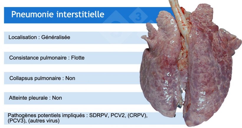 SDRP : virus du syndrome dysg&eacute;n&eacute;sique et respiratoire porcin ; PCV2 : circovirus porcin 2 ; CRPV : coronavirus respiratoire porcin ; PCV3 : circovirus porcin 3.
Le CRP, le PCV3 et d&#39;autres virus, tels que les ad&eacute;novirus, le virus de la maladie d&#39;Aujeszky et d&#39;autres, provoquent souvent des pneumonies interstitielles l&eacute;g&egrave;res.
