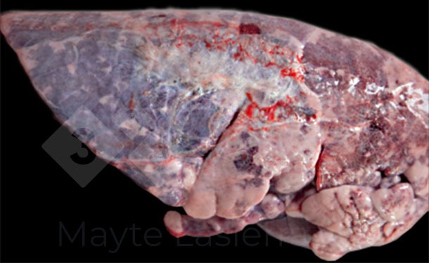 Pleur&eacute;sie dorsocaudale
