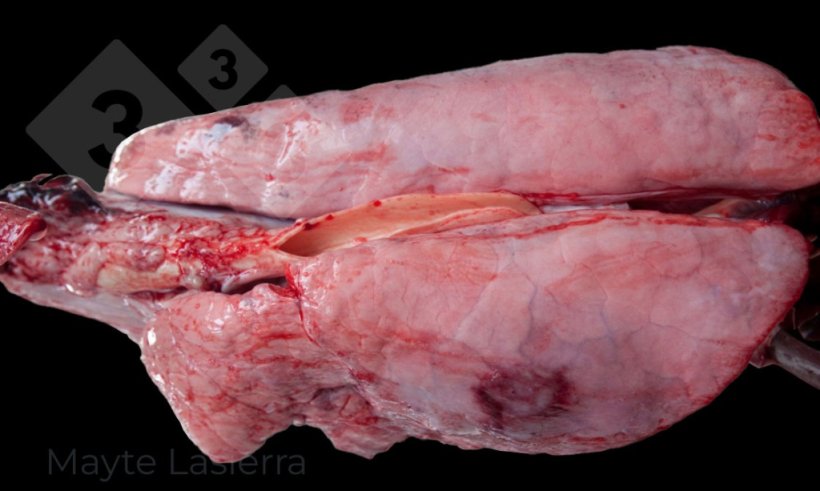 Pleur&eacute;sie dorsocaudale
